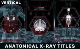 Videohive Anatomical X-Ray Titles Vertical